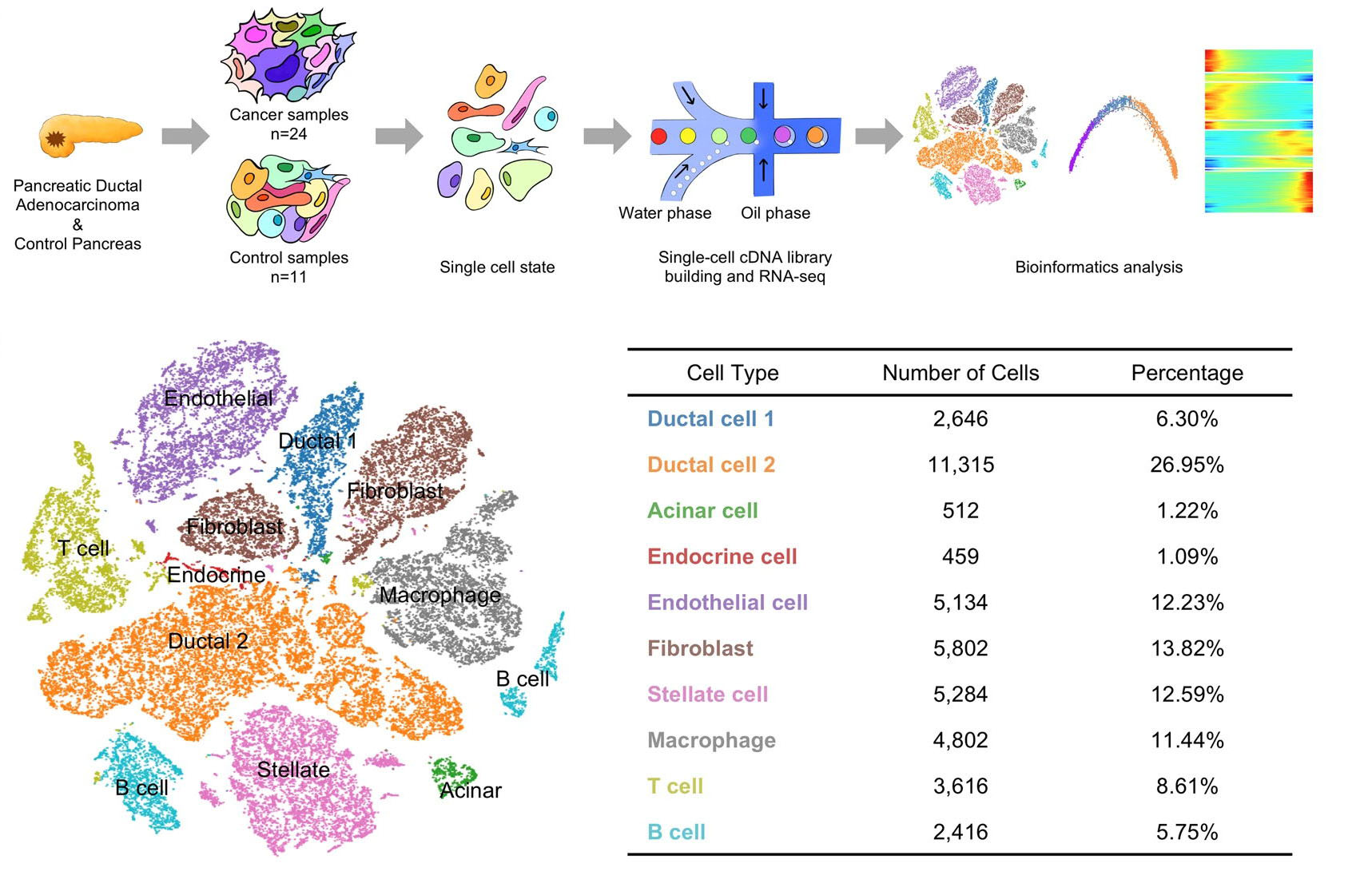 Scientists Reveal High Heterogeneity of Tumor and Tumor Microenvironment in PDAC