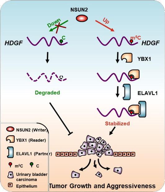 Scientists Reveal Mechanisms for Regulating Tumorigenesis of Bladder Cancer by RNA 5-methylcytosine